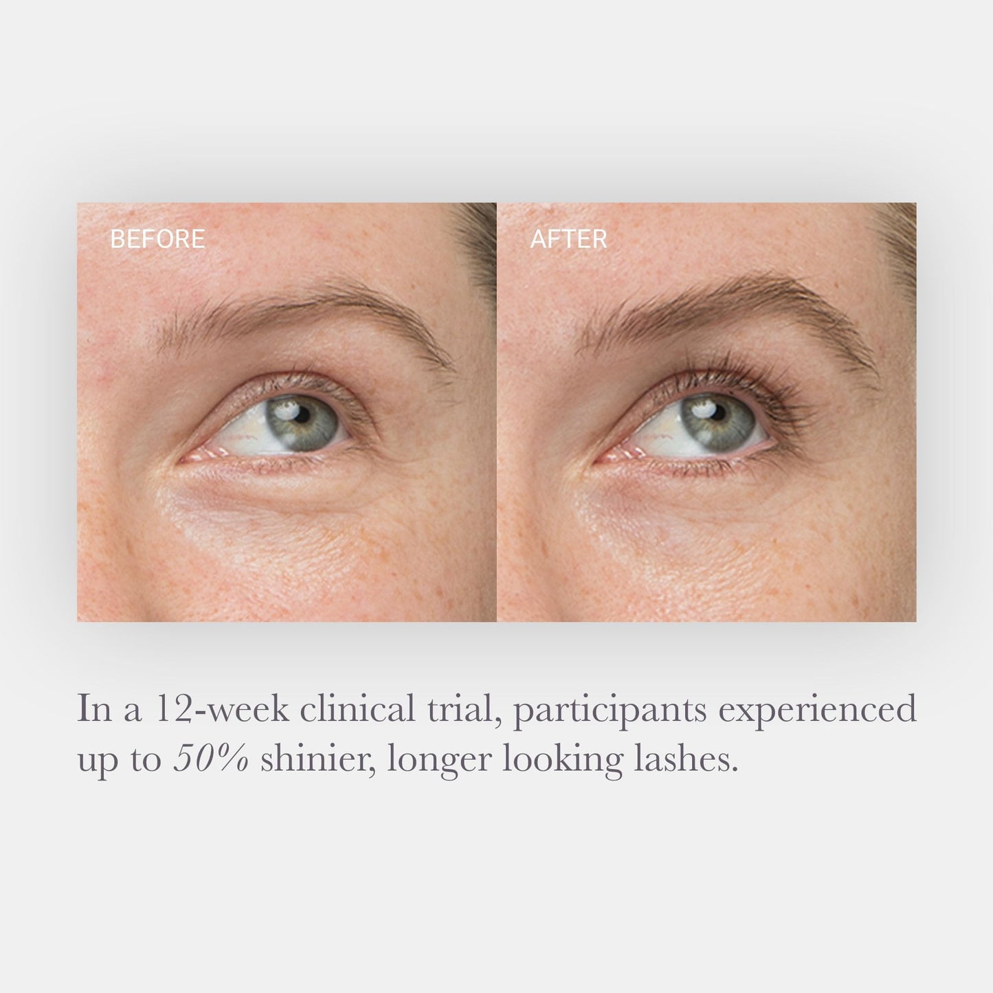 NULASTIN Lash Boosting Serum – Promotes Longer, Fuller, Thicker Looking Lashes | Follicle Strengthening Eyelash Enhancing Formula with Elastin Technology